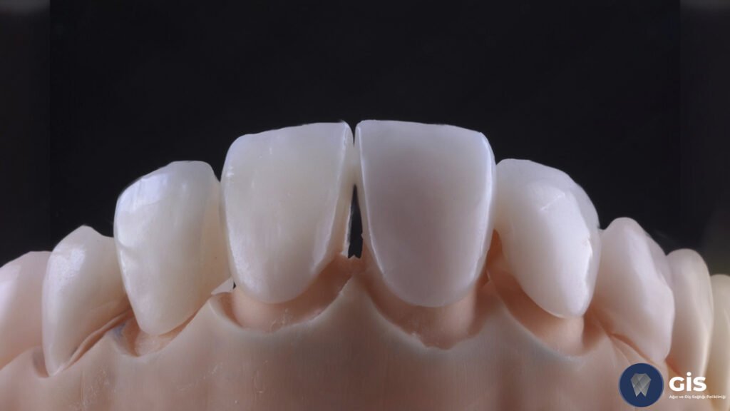 Laminated Coating