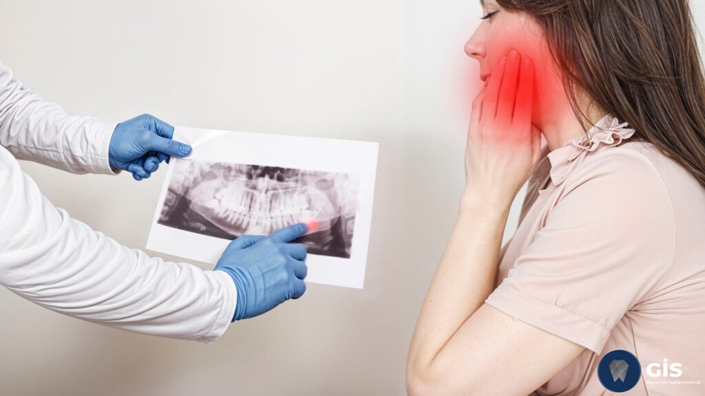 Abscessed Toothache
